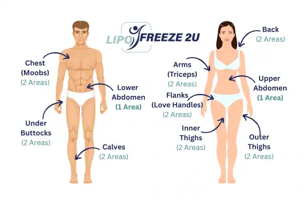 Areas you can have fat freezing treatment Solihull