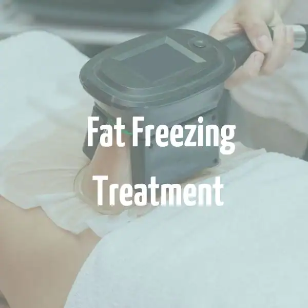 fat freezing treatment Solihull