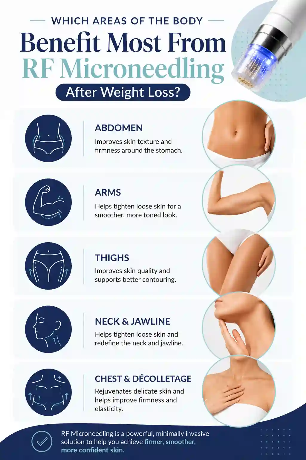 Which Areas of the Body Benefit Most From RF Microneedling After Weight Loss Solihull